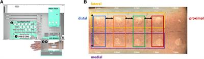 Evaluation of skin prick location on the forearm using a novel skin prick automated test device